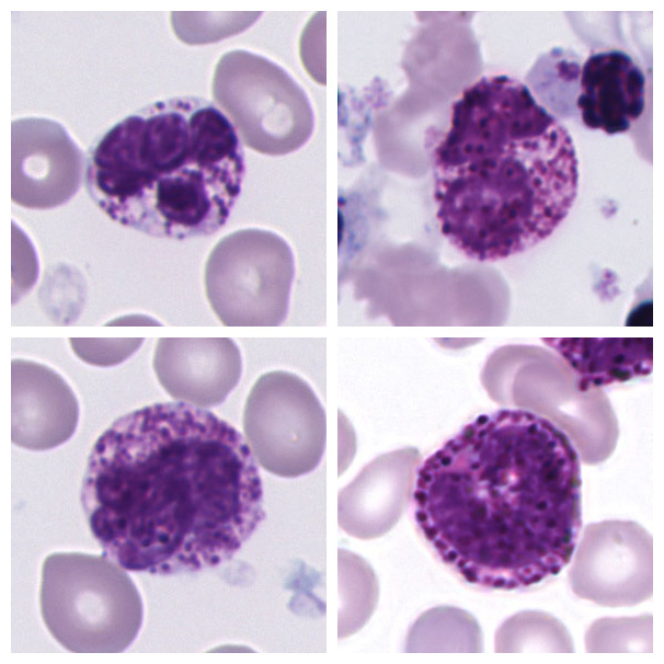Basophil