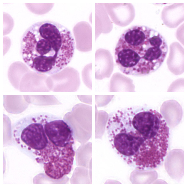 Eosinophil
