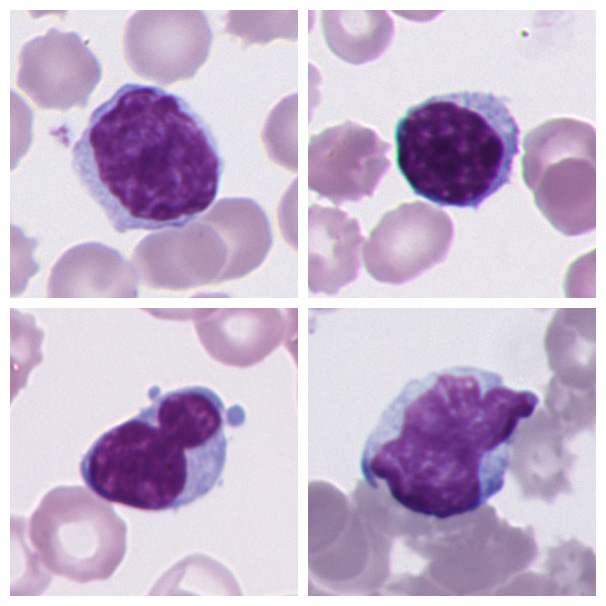 Lymphocyte