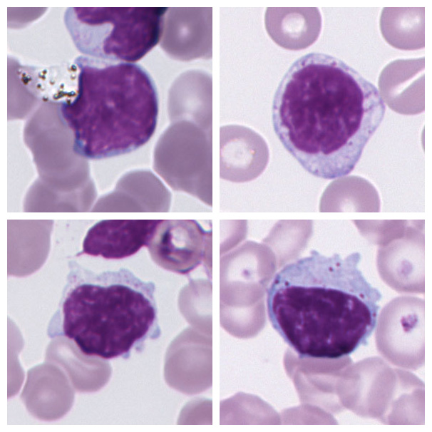Lymphocyte (Large Granular)