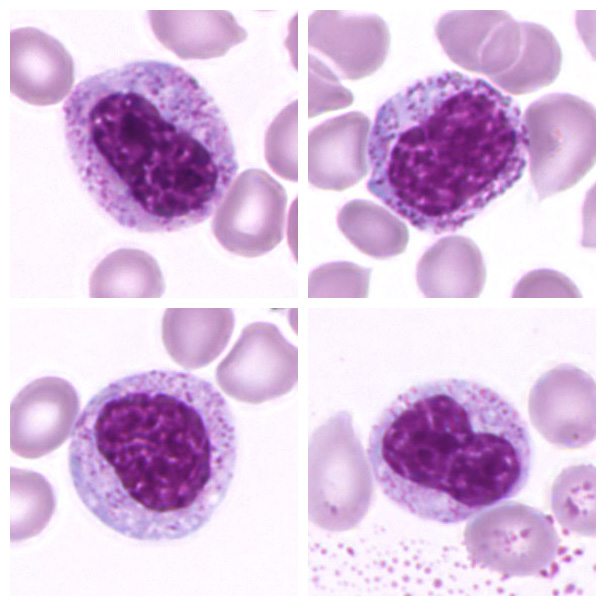 Metamyelocyte