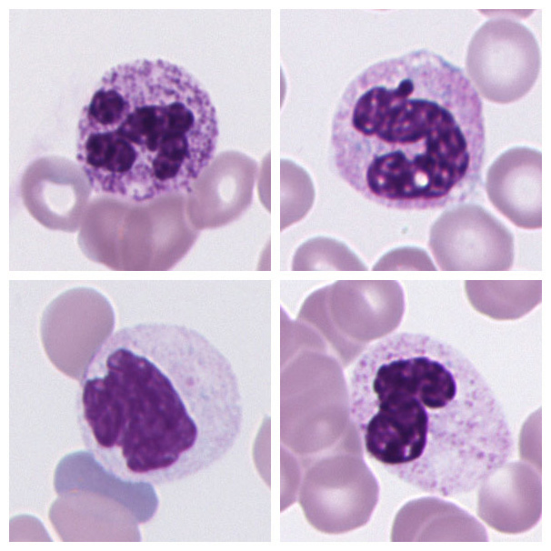 Neutrophil Segmented